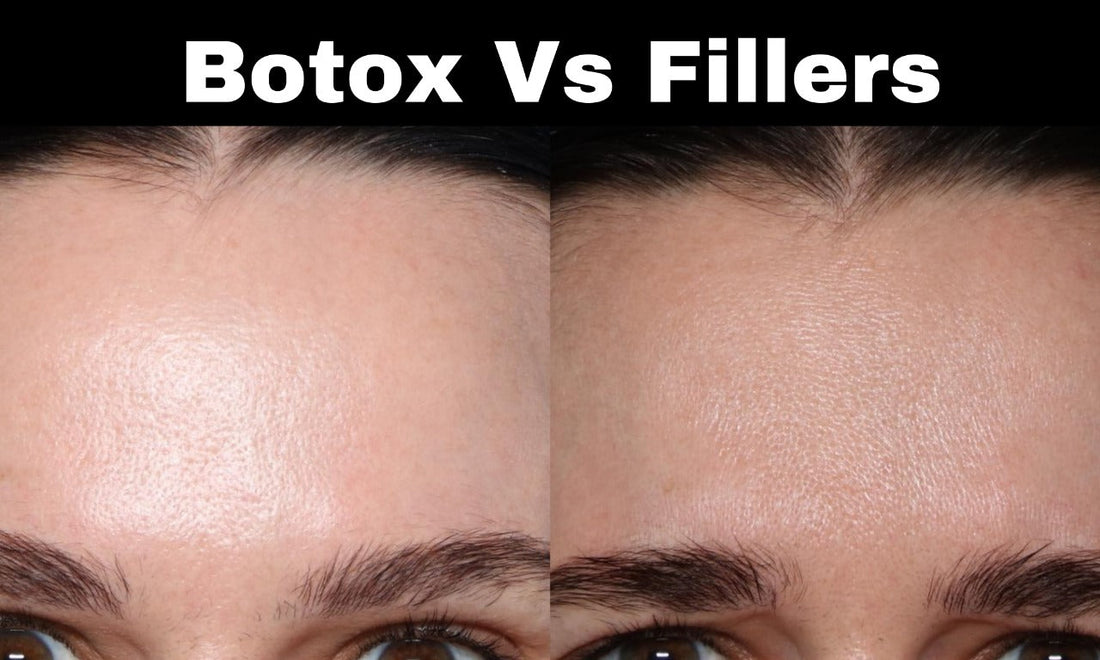 Botox vs. Fillers: Uses, Effects, and Differences