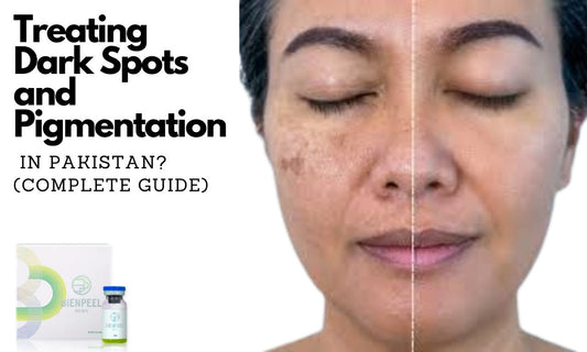 A Complete Guide to Treating Dark Spots and Pigmentation in Pakistan